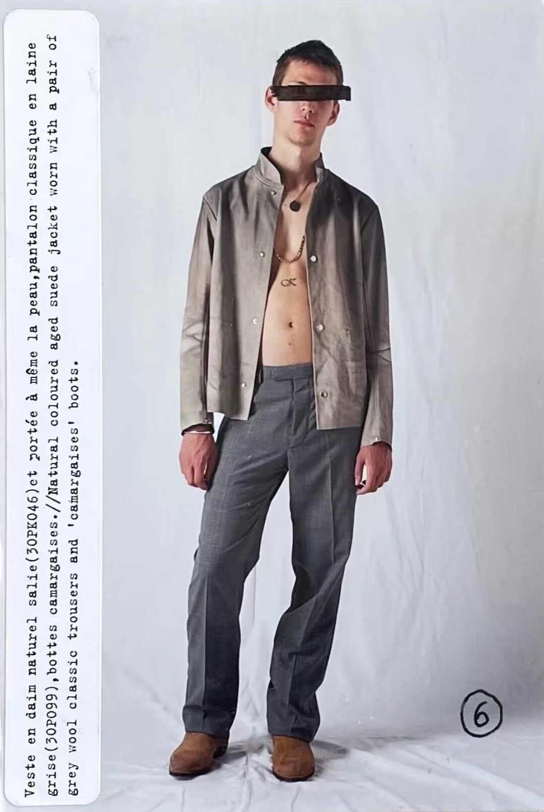 Maison Martin Margiela 2003 Distressed Jacket — front